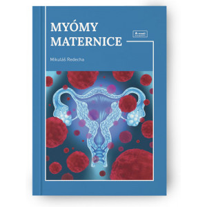 Myómy maternice