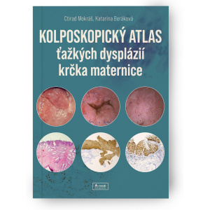 Kolposkopický atlas ťažkých...